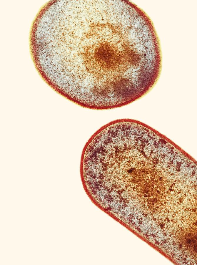 Clostridium Difficile Bacteria Tem Photograph By Dr Kari Lounatmaa