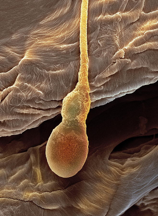 Deformed Sperm Cell Sem Photograph By Steve Gschmeissner Fine Art America