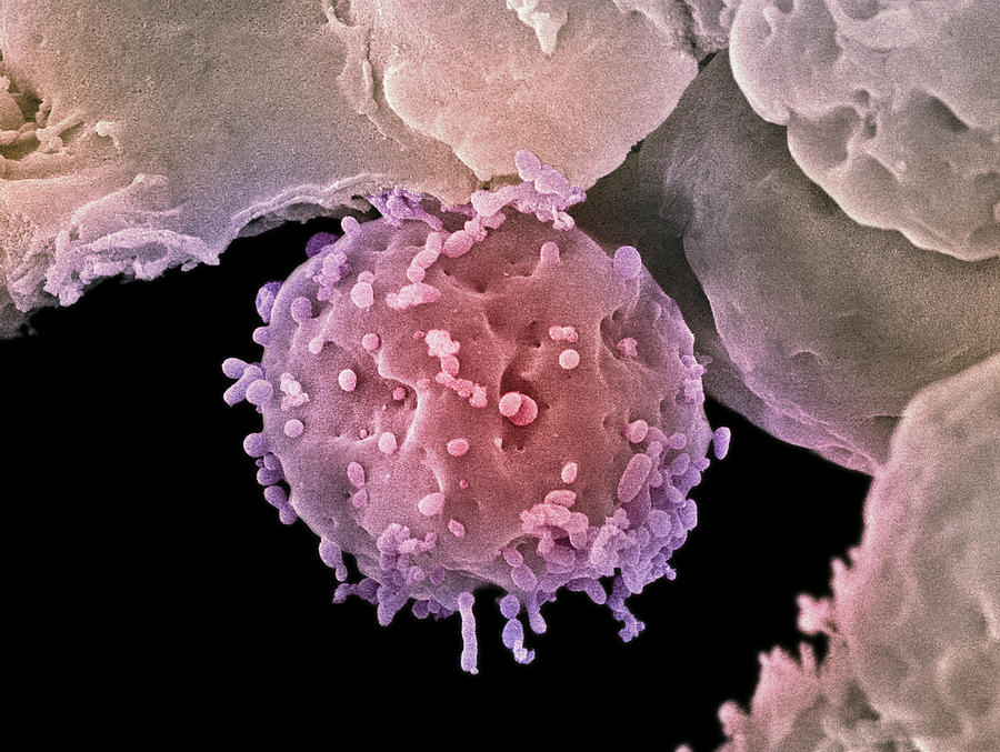Embryonic Stem Cell Photograph - Embryonic Stem Cells, Sem #10 by Steve Gschmeissner
