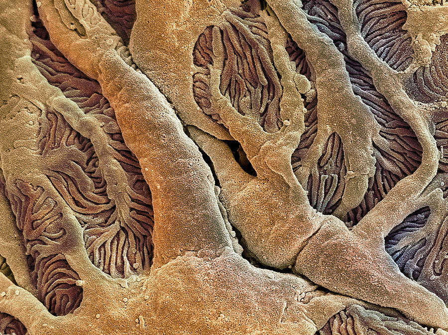 Bowman's Capsule Photograph - Kidney Glomerulus, Sem #10 by Steve Gschmeissner