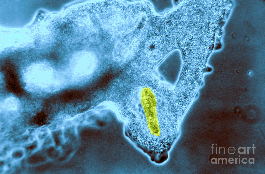 Light Micrograph Of Amoeba Catching #10 Photograph by Eric V. Grave