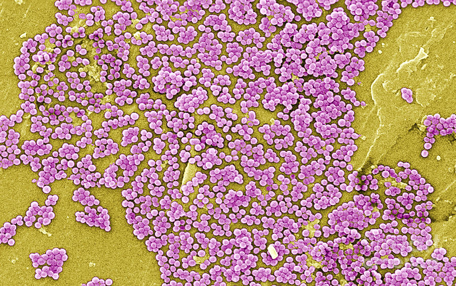 Methicillin-resistant Staphylococcus #10 Photograph by Science Source