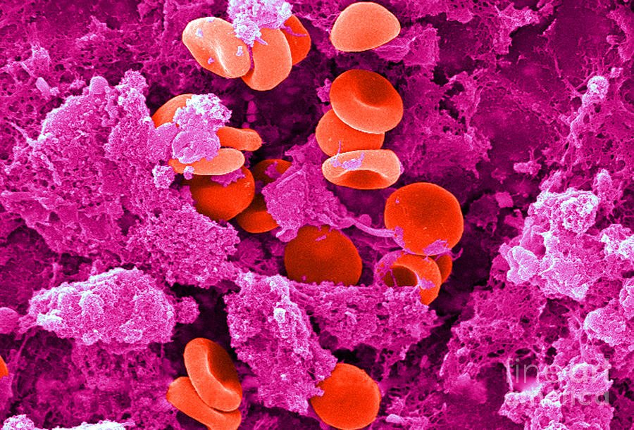 Red Blood Cells, Sem #10 Photograph by Science Source