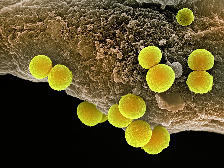Staphylococcus aureus Bacteria, Scanning electron micrograp…
