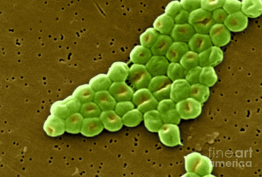 Acinetobacter Baumannii, Sem #11 Photograph by Science Source