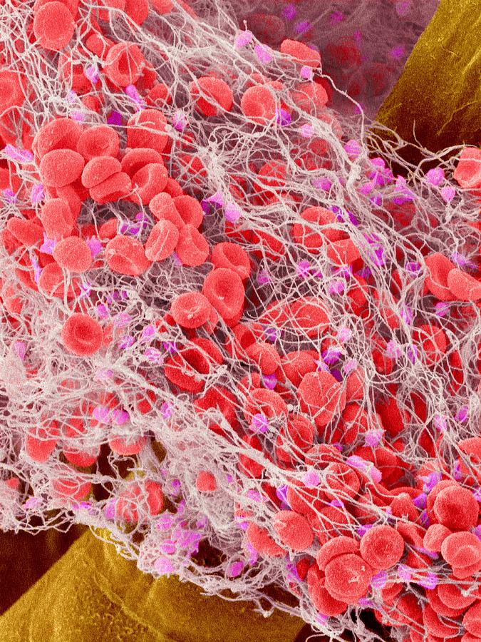 Blood Clot, Sem Photograph by Susumu Nishinaga