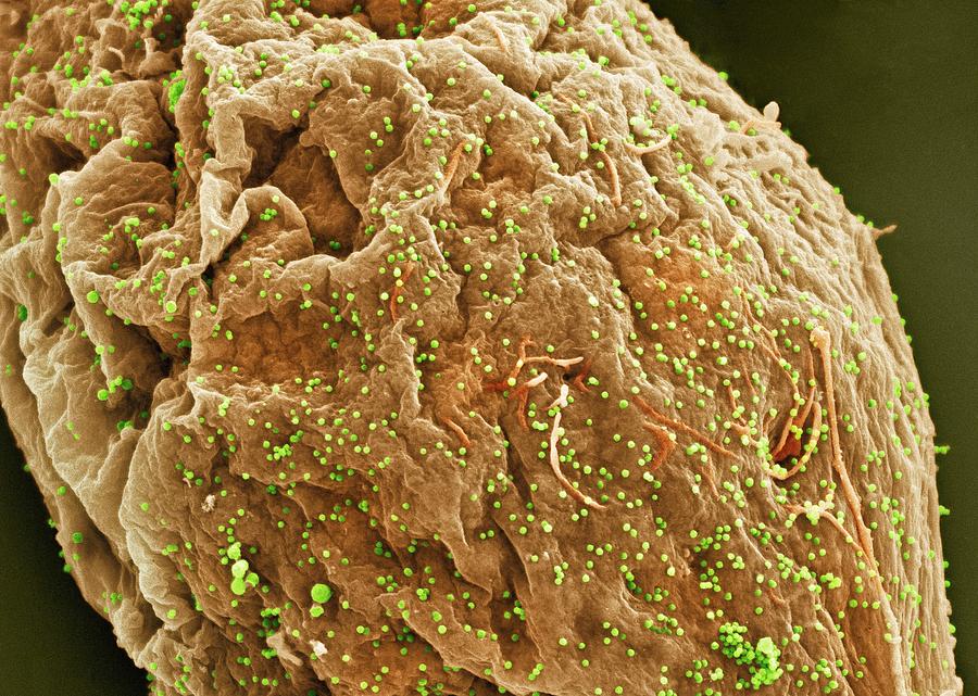 Hiv Photograph - Cell Infected With Hiv, Sem #11 by Thomas Deerinck, Ncmir