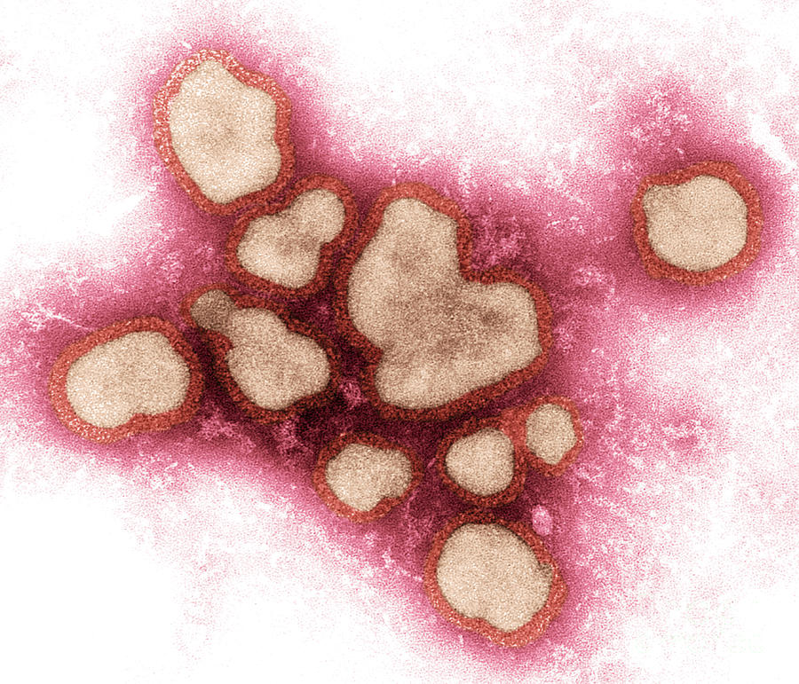 Influenza A Virus #11 Photograph by Science Source