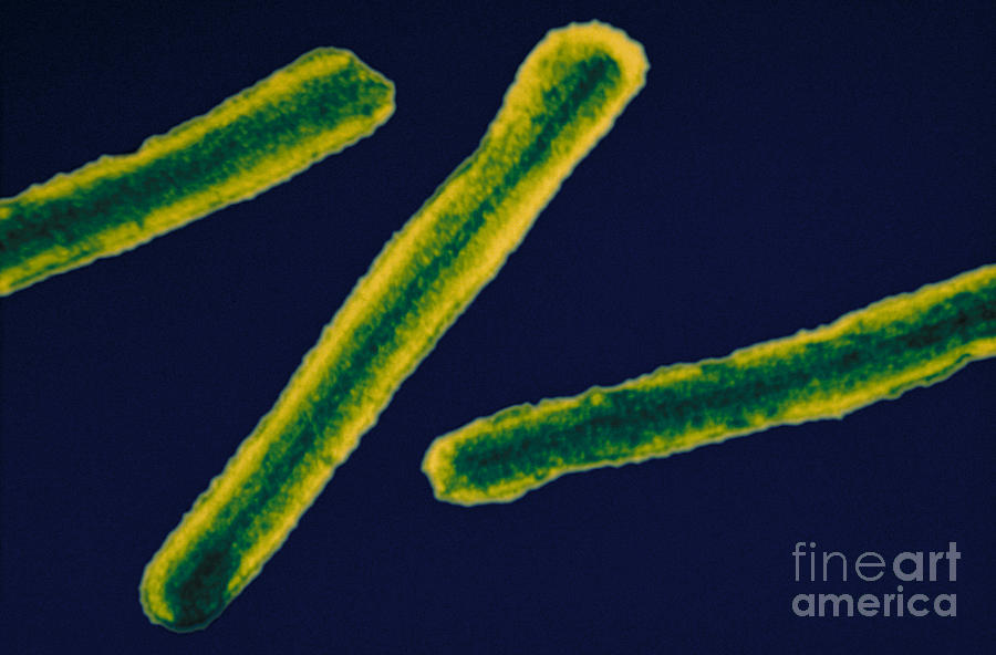 Marburg Virus, Tem #11 Photograph by Science Source