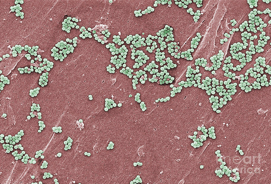 Methicillin-resistant Staphylococcus #11 Photograph by Science Source