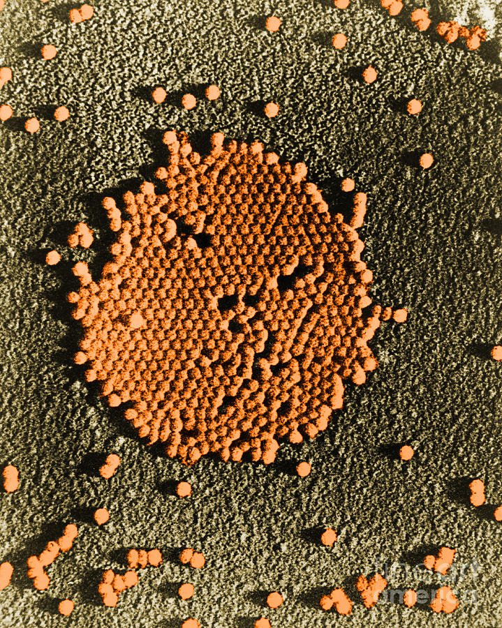 Poliovirus, Tem #11 Photograph by Science Source