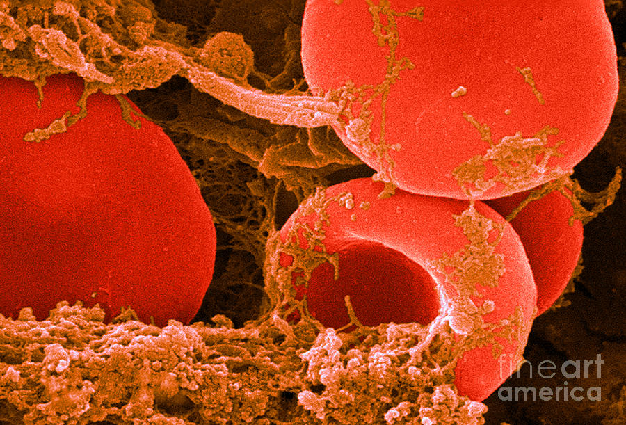 Red Blood Cells, Sem #11 Photograph by Science Source