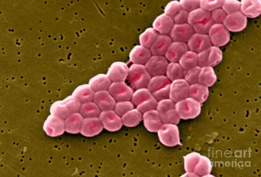 Acinetobacter Baumannii, Sem #12 Photograph by Science Source