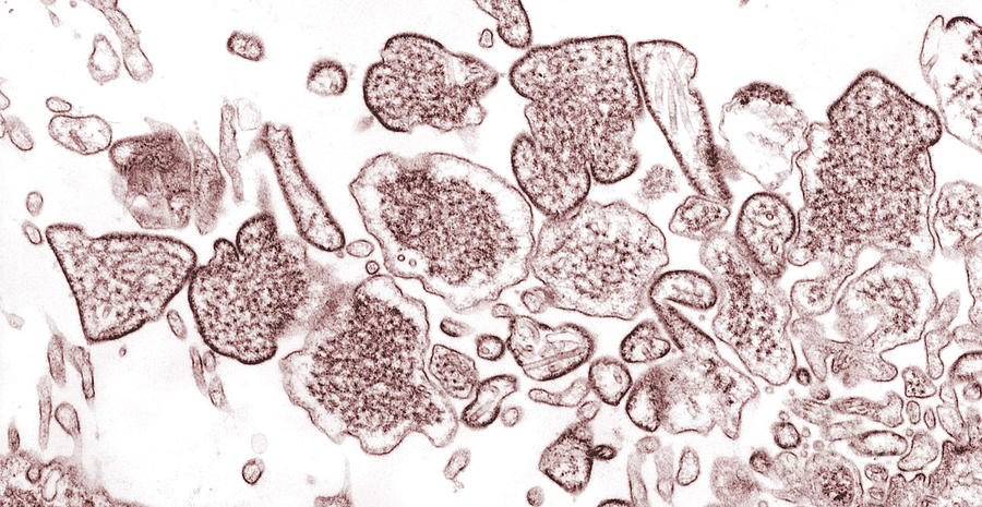 Nipah Virus #12 Photograph by Science Source