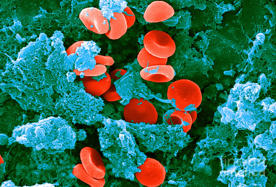 Red Blood Cells, Sem #12 Photograph by Science Source