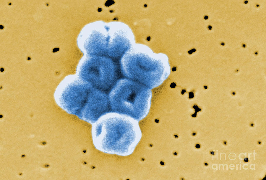 Acinetobacter Baumannii, Sem #13 Photograph by Science Source
