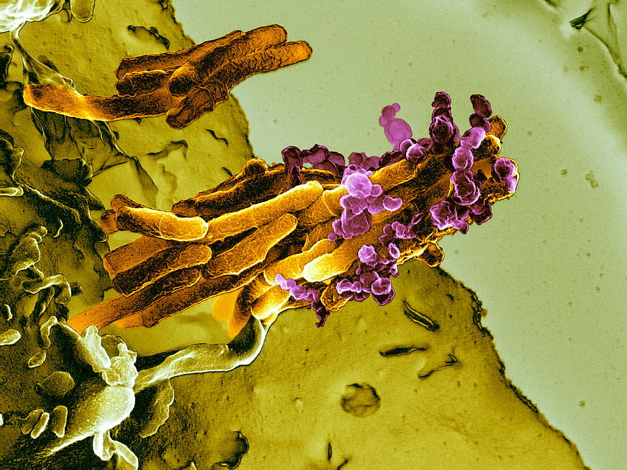 Mycobacterium Tuberculosis Photograph - Bacteria Infecting A Macrophage, Sem #13 by 