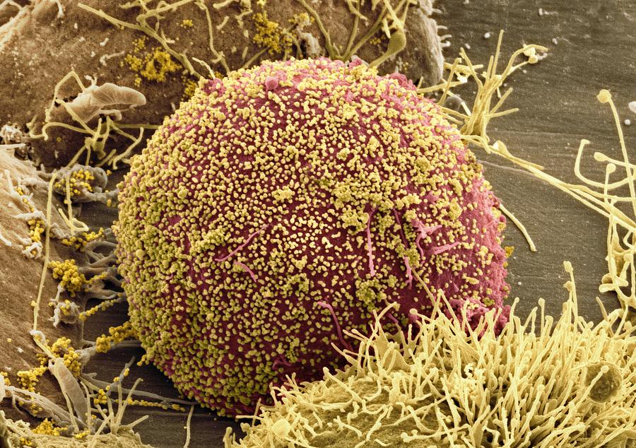 Hiv Photograph - Cell Infected With Hiv, Sem #13 by Thomas Deerinck, Ncmir