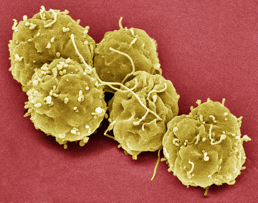 Embryonic Stem Cell Photograph - Embryonic Stem Cells, Sem #13 by Steve Gschmeissner