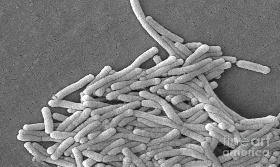 Legionella Pneumophila #13 Photograph by Science Source