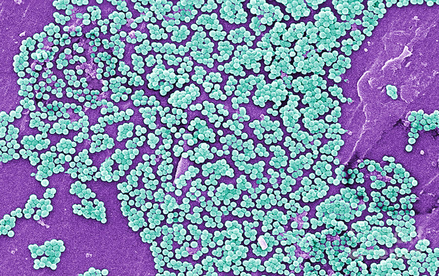 Methicillin-resistant Staphylococcus #13 Photograph by Science Source