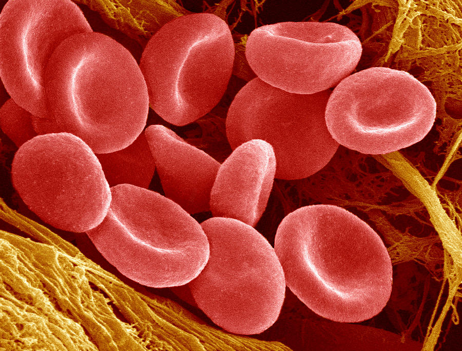 Клетки крови. Клетки крови эритроциты. Малокровие 6