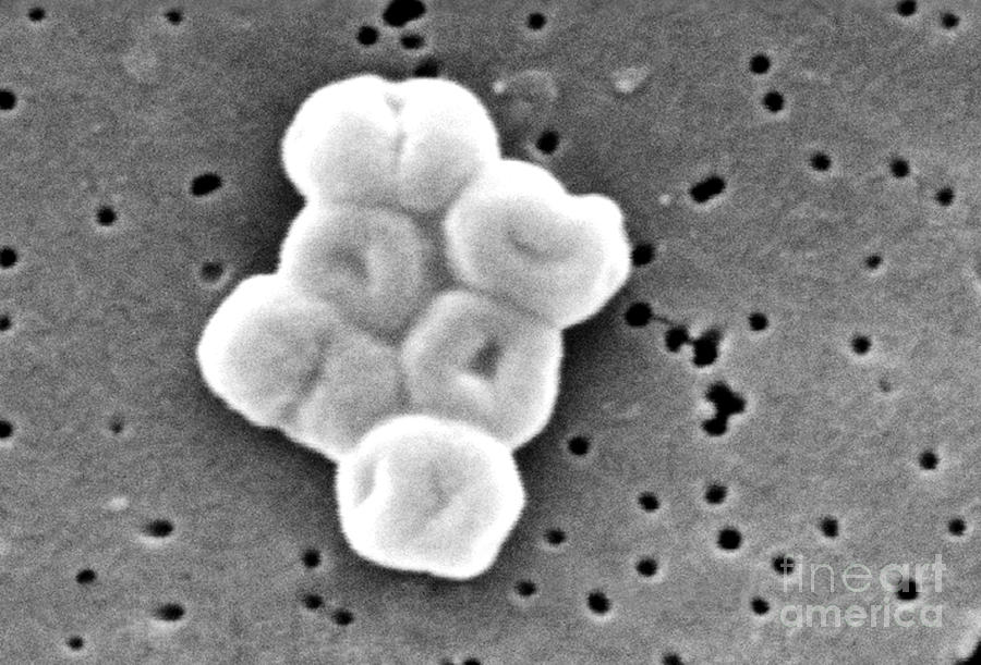 Acinetobacter Baumannii, Sem #14 Photograph by Science Source