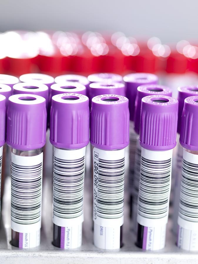 Blood Samples 14 Photograph by Tek Image Fine Art America