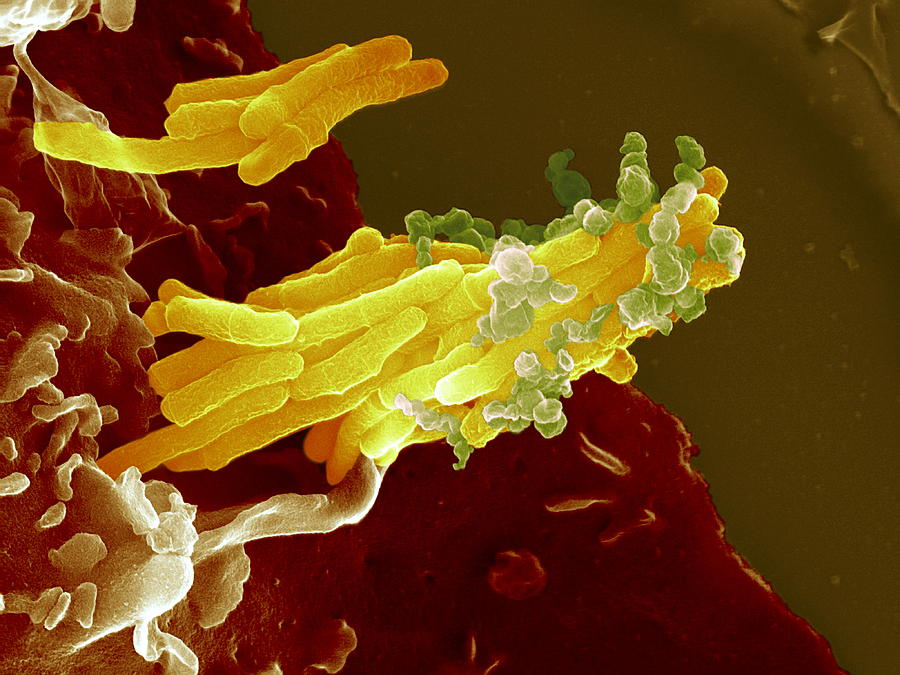 Mycobacterium Tuberculosis Photograph - Bacteria Infecting A Macrophage, Sem #16 by 