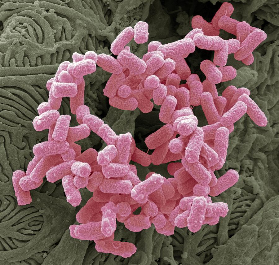 Escherichia Coli Photograph - E. Coli Bacteria, Sem #16 by Steve Gschmeissner