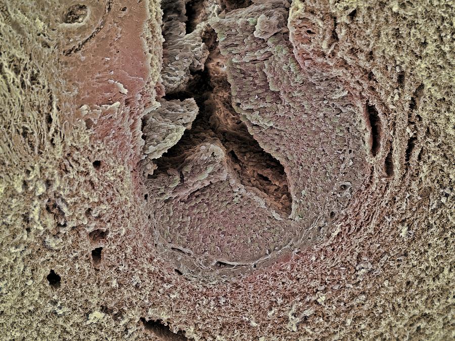 Human Body Photograph - Fallopian Tube, Sem #16 by Steve Gschmeissner