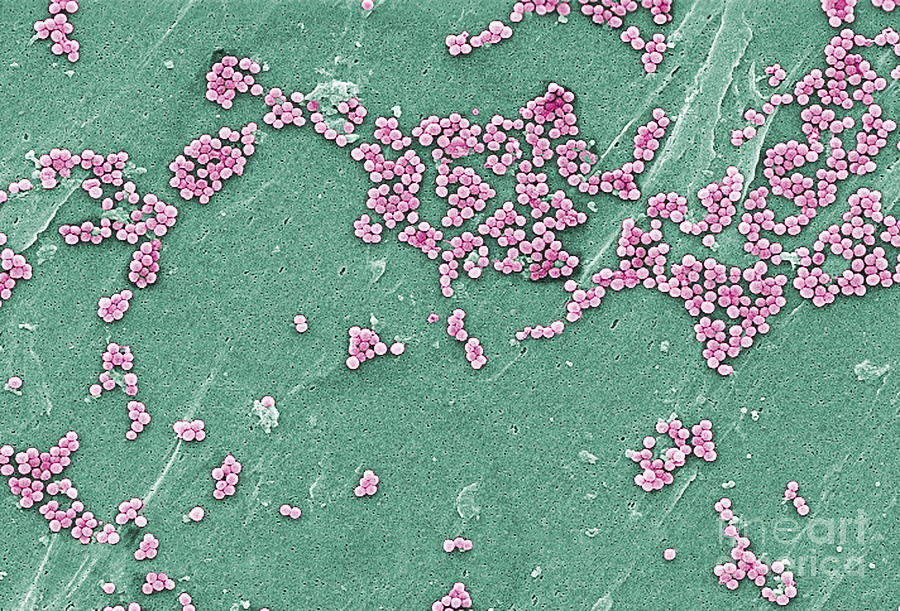 Methicillin-resistant Staphylococcus #16 Photograph by Science Source