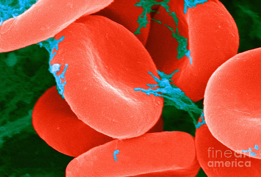 Red Blood Cells Sem #5 Photograph by Science Source