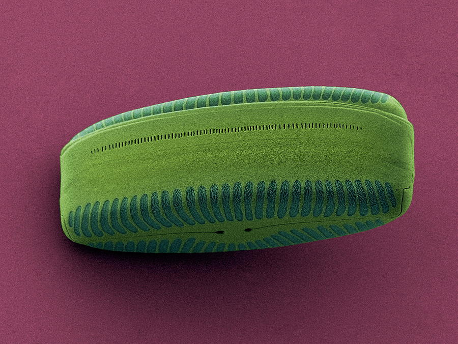 Nature Photograph - Diatom, Sem #17 by Steve Gschmeissner