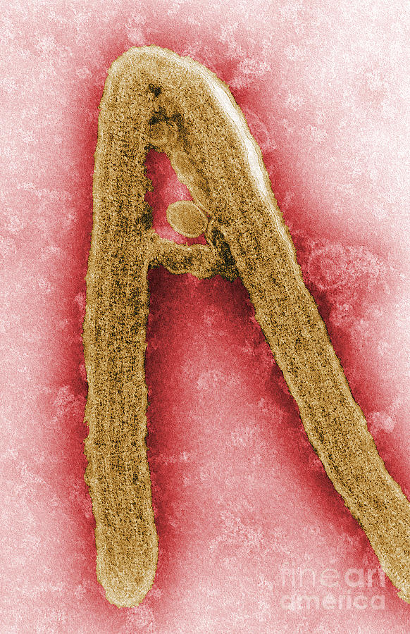 Marburg Virus, Tem #17  by Science Source