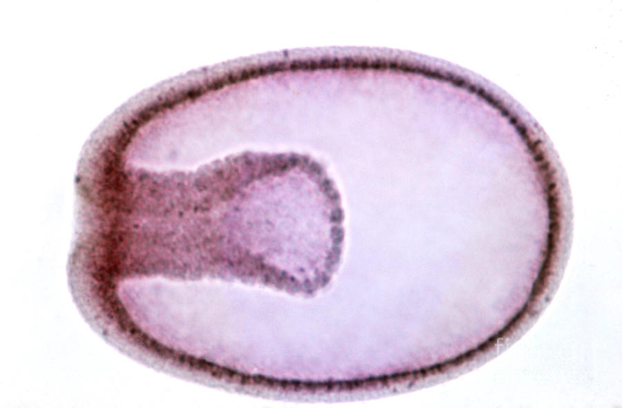 Starfish Photograph - Starfish Embryo #17 by Science Source