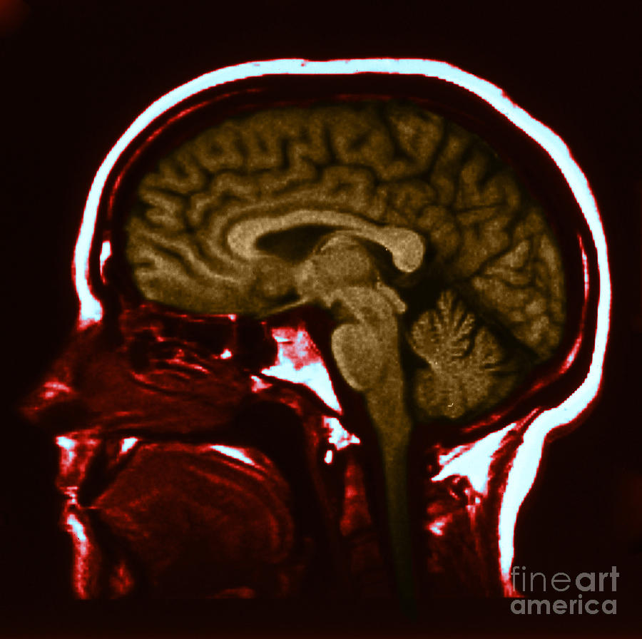 Mri Of Normal Brain #18 Photograph by Science Source