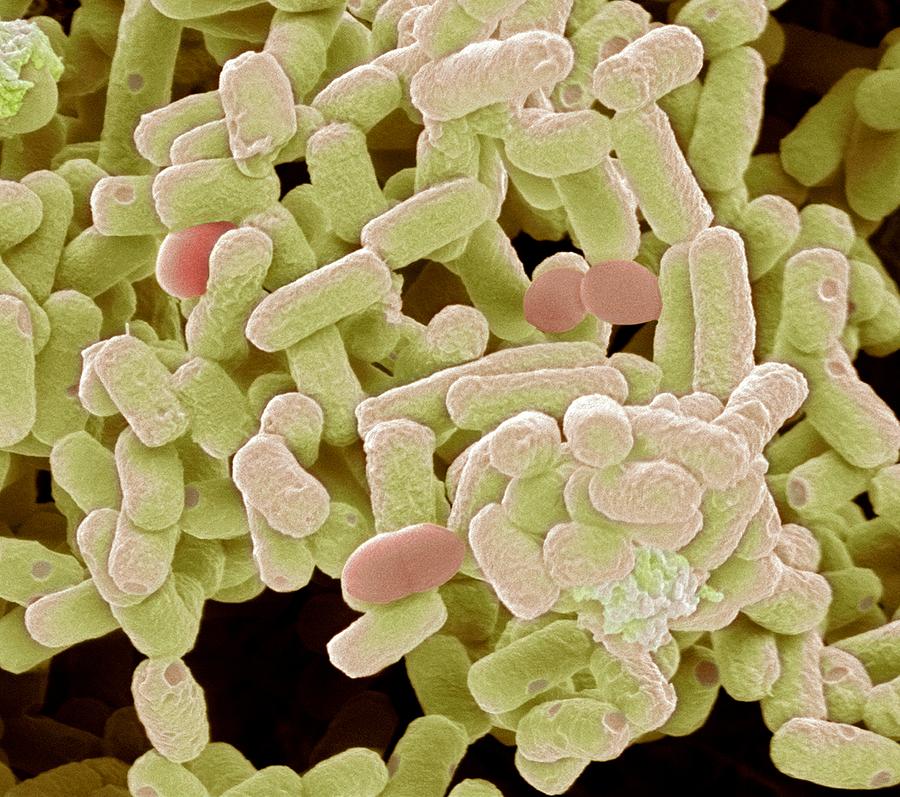 Bacterium Photograph - E Coli Bacteria, Sem #19 by Steve Gschmeissner