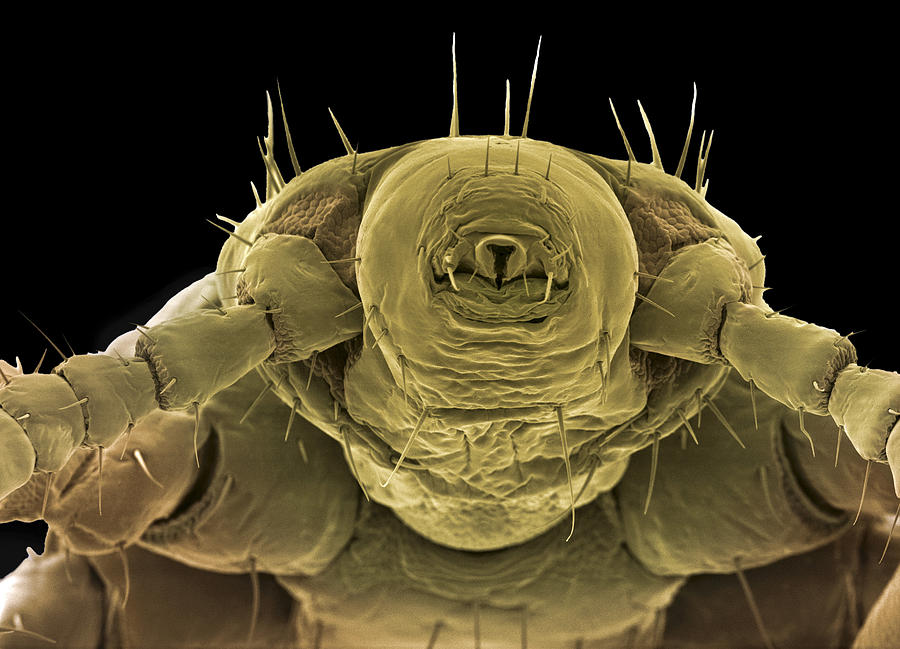 Вша человеческая фото как выглядит под микроскопом