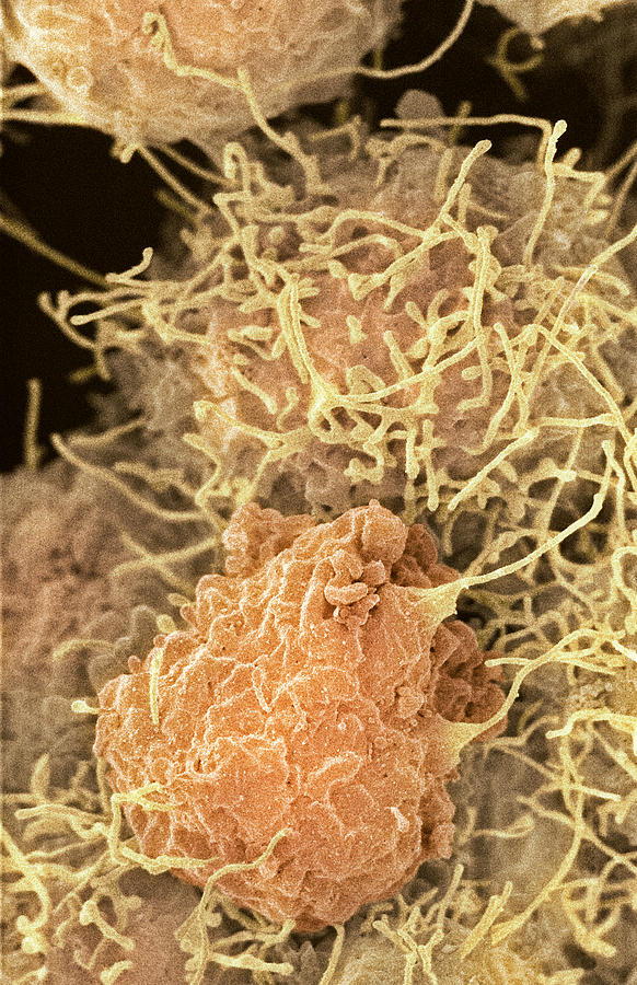 Cell Photograph - Stem Cells, Sem #19 by 