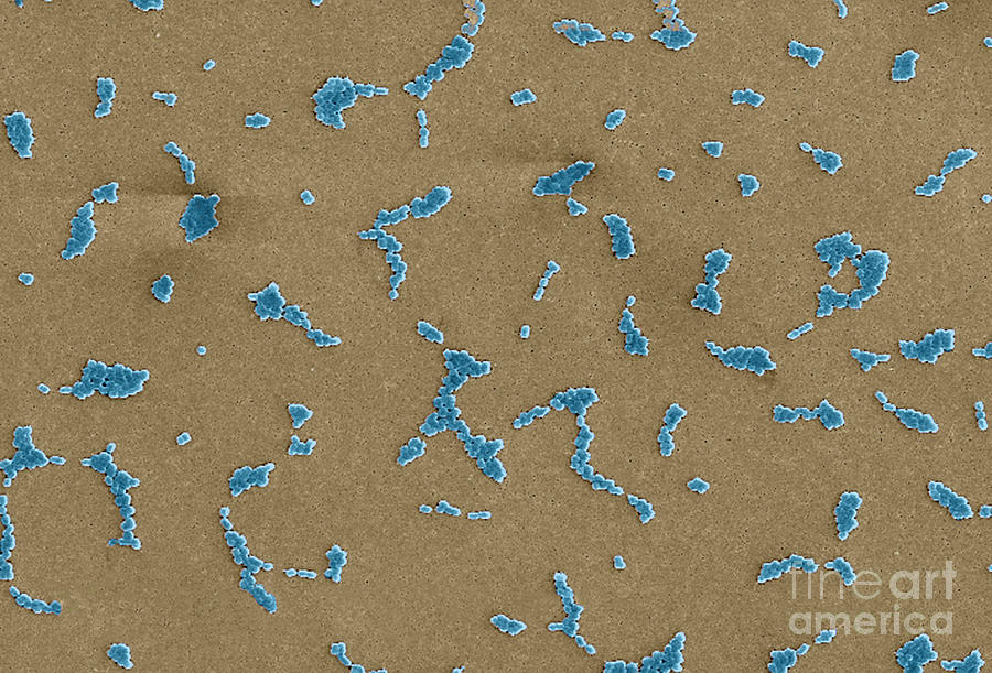 Acinetobacter Baumannii Bacteria, Sem #2 Photograph by Science Source