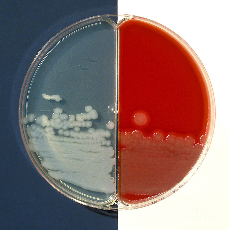 Bacillus Cereus Culture #2 Photograph by Science Source