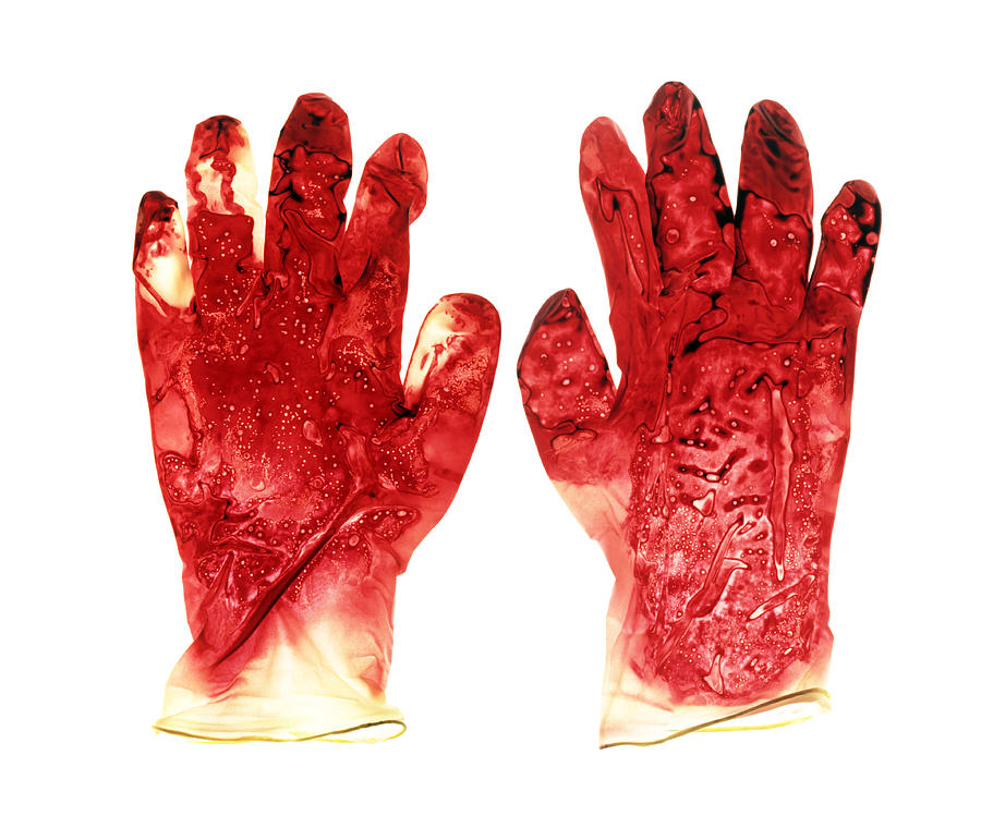 Blood-stained Surgical Gloves #2 Photograph by Kevin Curtis