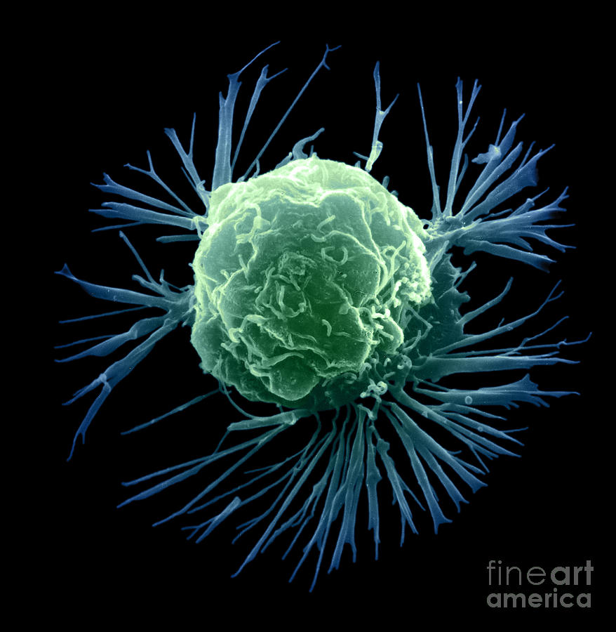 Sem Photograph - Breast Cancer Cell #3 by Science Source