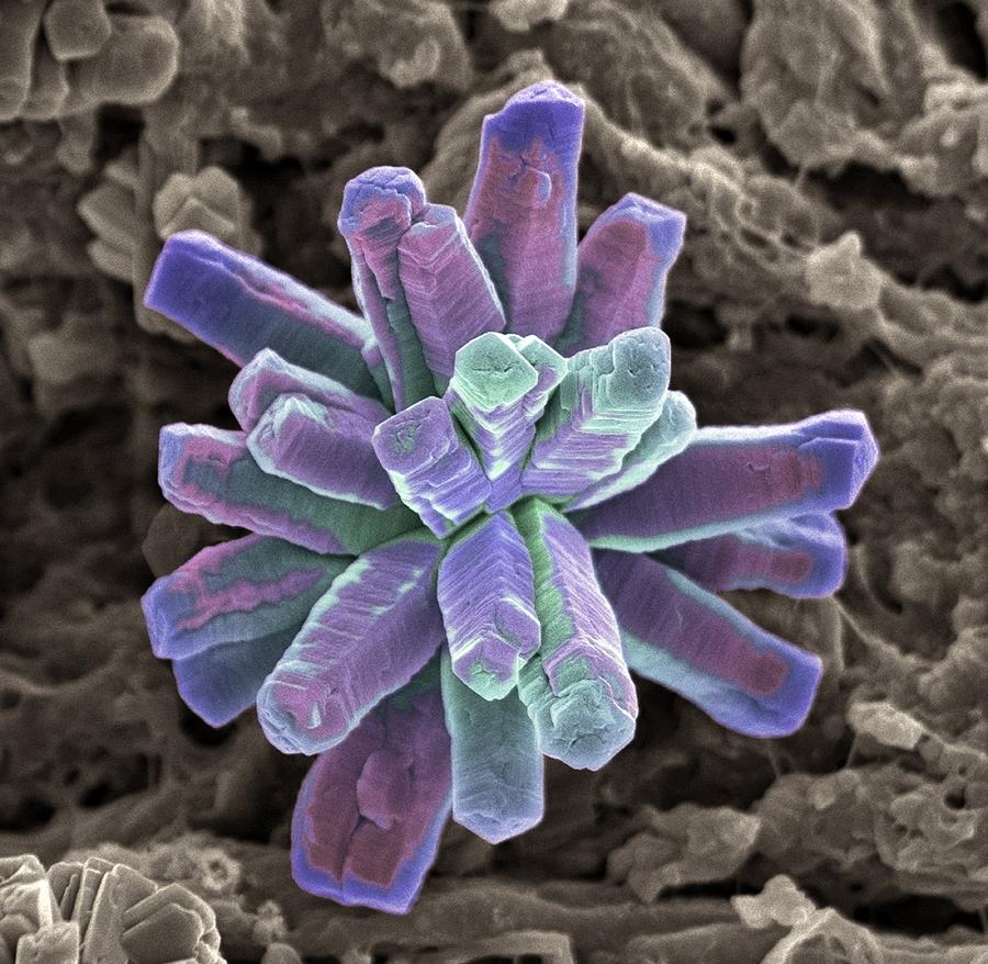 Calcium Phosphate Crystal, Sem Photograph by Steve Gschmeissner