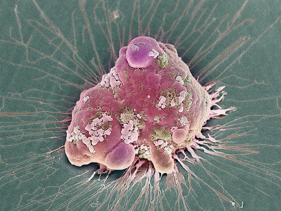 Cancer Cell Apoptosis Sem 2 Photograph By Steve Gschmeissner Pixels