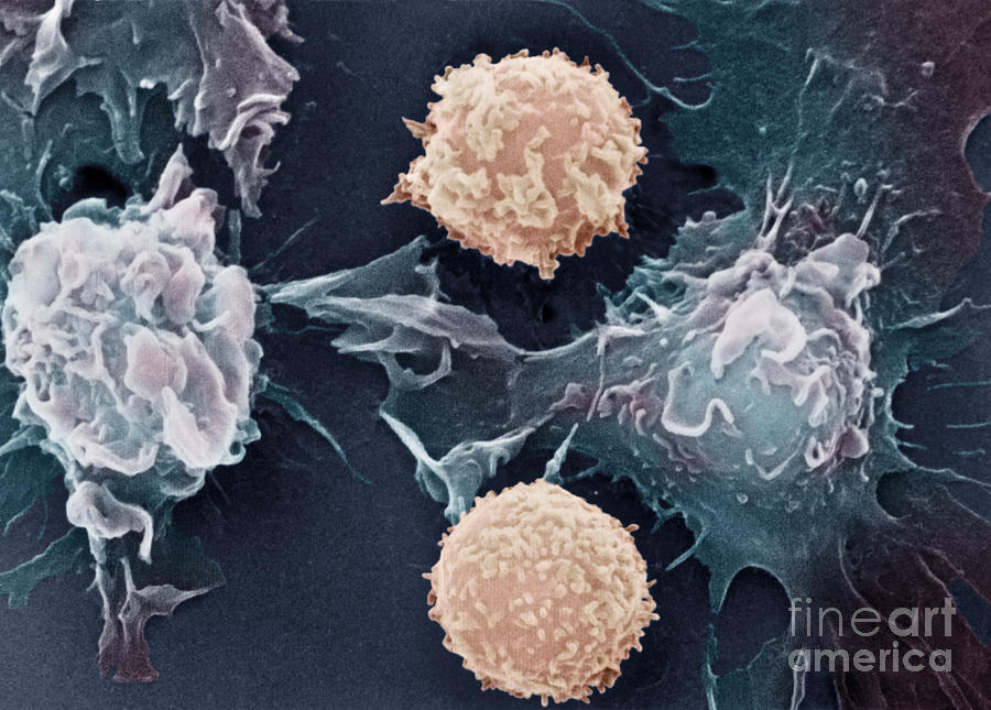 Cancer Cells #2 Photograph by Science Source