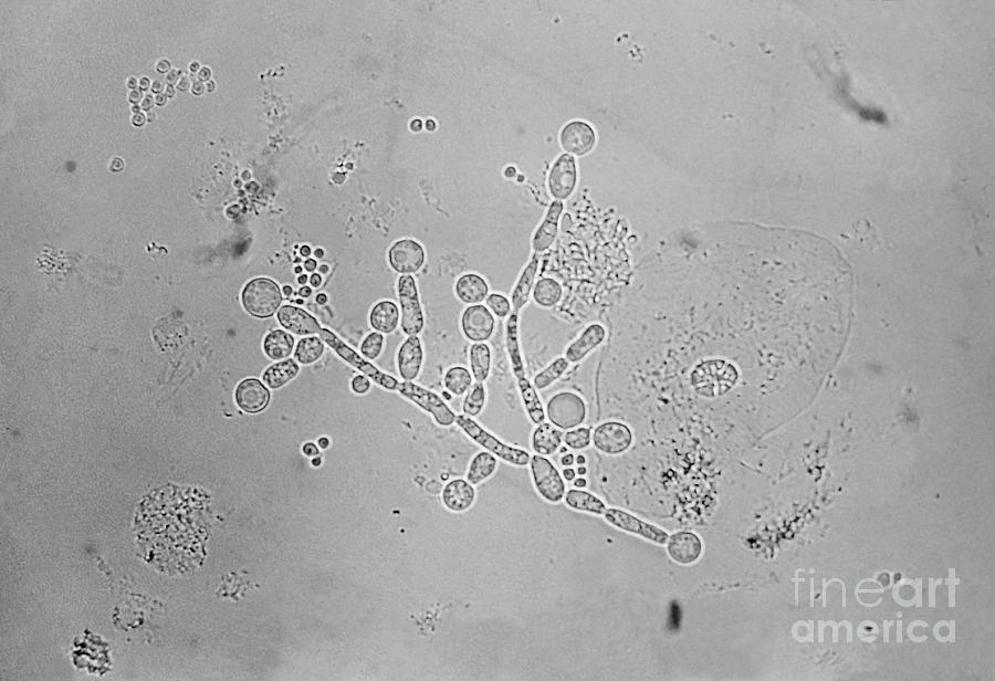 Candida Albicans Photograph By Science Source Fine Art America 