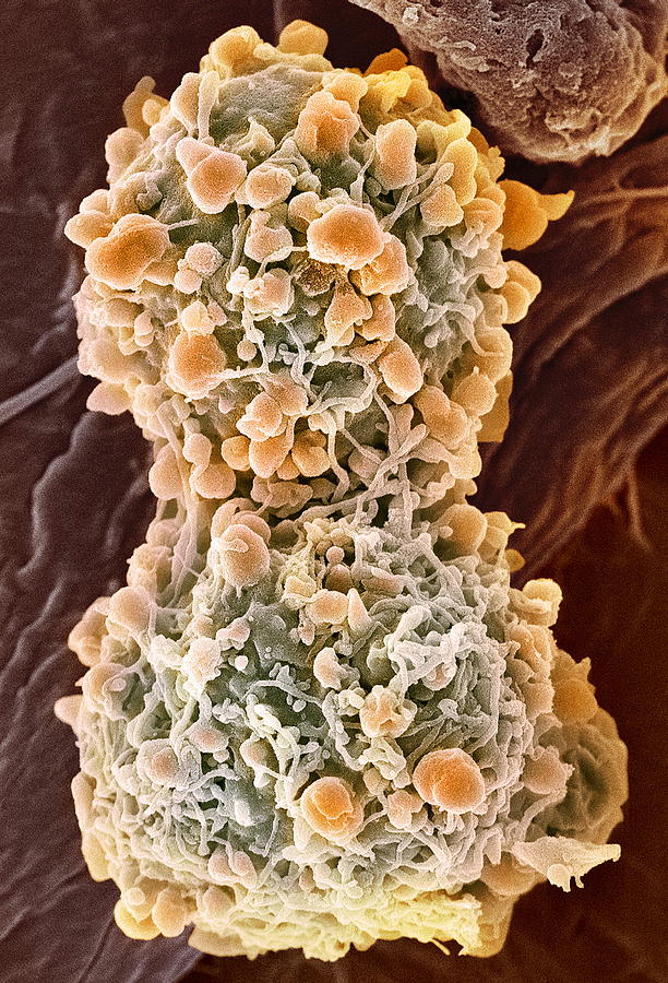 Cervical Cancer Cells Dividing Sem Photograph By Steve Gschmeissner Fine Art America