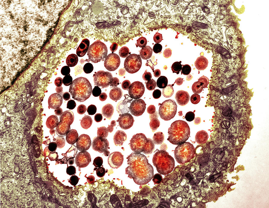 Chlamydia Trachomatis Photograph - Chlamydia Trachomatis Bacteria, Tem #2 by Biomedical Imaging Unit, Southampton General Hospital